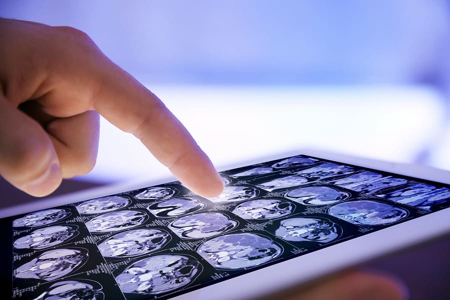 A close-up of a doctor touching the screen of an iPad displaying several CT scan images on a mobile healthcare app.